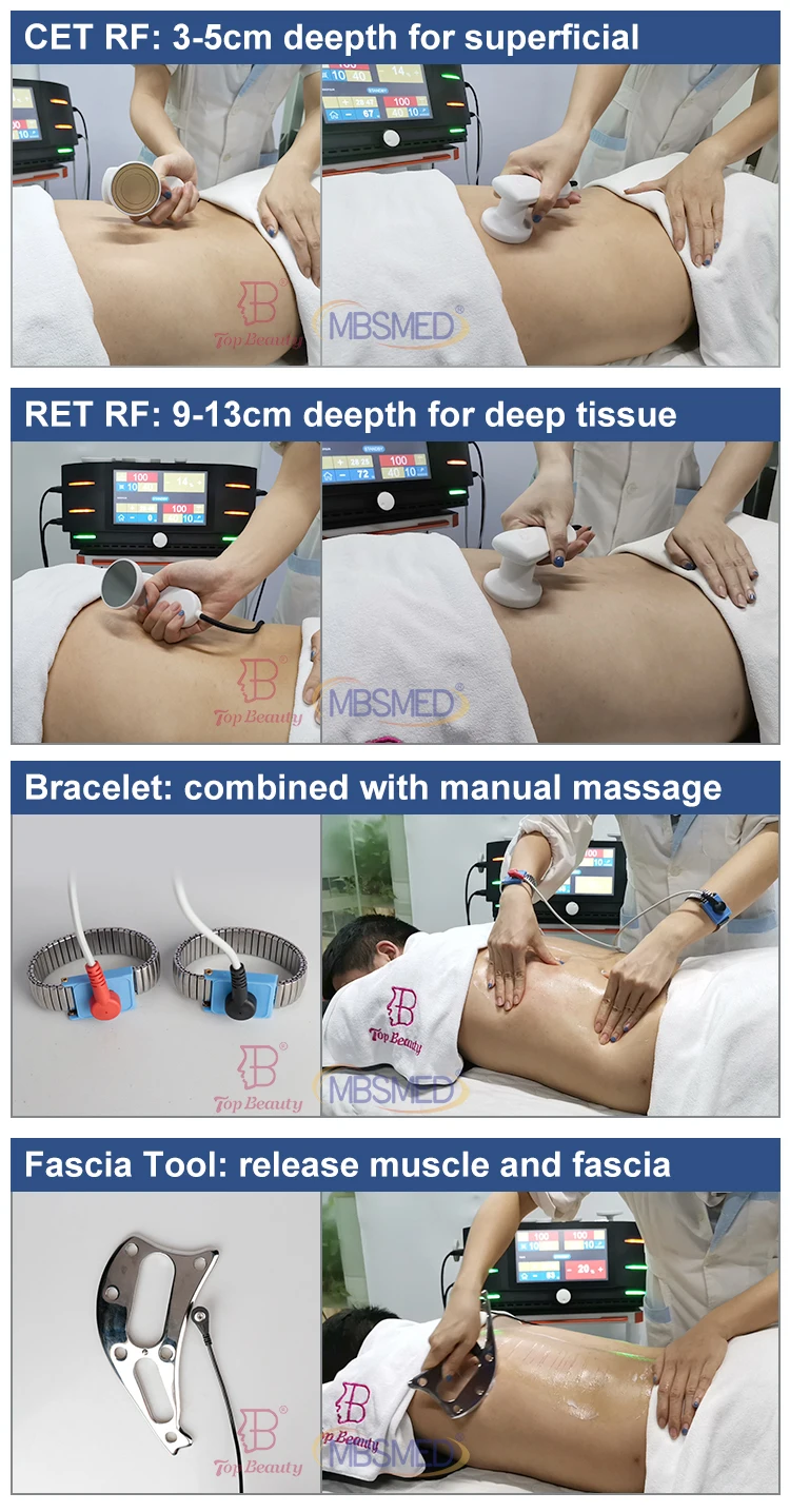 Indiba Radiofrequency Therapy Cet Ret Tecar Indiba 448Khz Tecar Therapy Machine