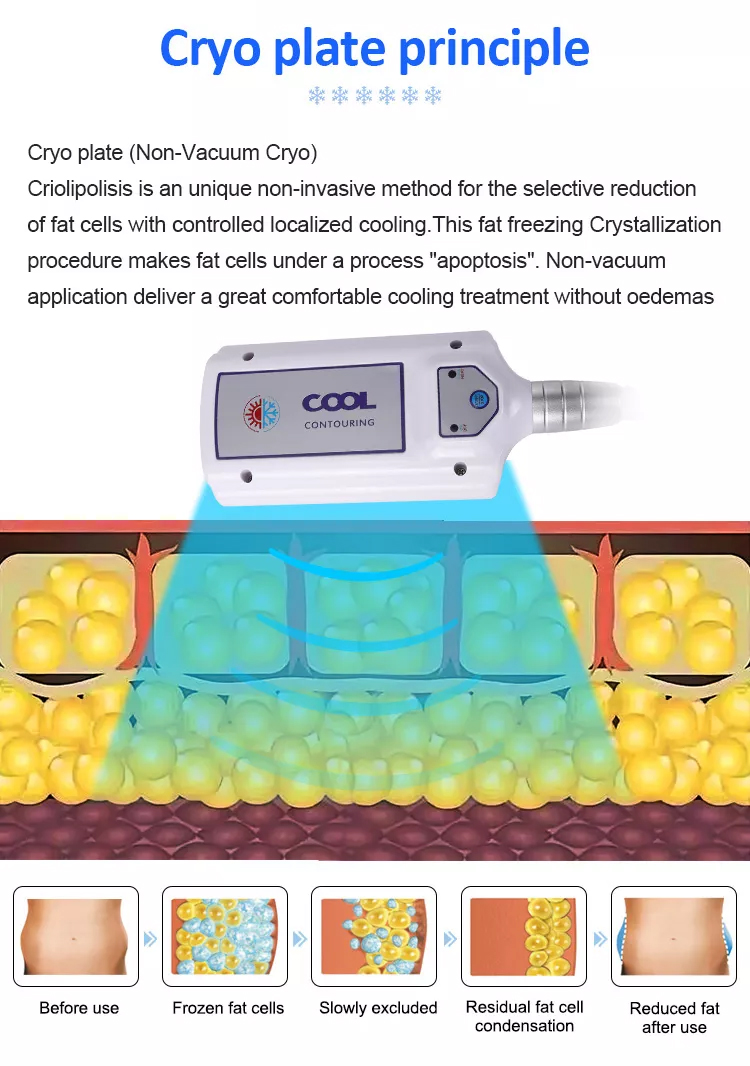 2023年最新脂肪减少冷冻垫瘦身机Cryolipolysis机器Coldtec脂肪冷冻Cryolipolysis设备