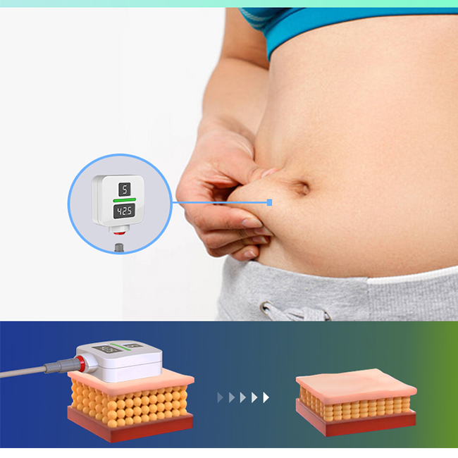 Trushape ID トリートメント EMS 電気的筋肉刺激 ボディ スカルプティング Emslim マシン