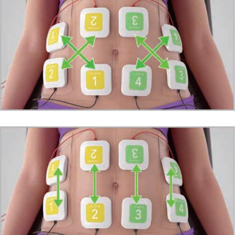 プロフェッショナル Trusculpt ID EMS 電気筋肉刺激ボディシェイプマシン