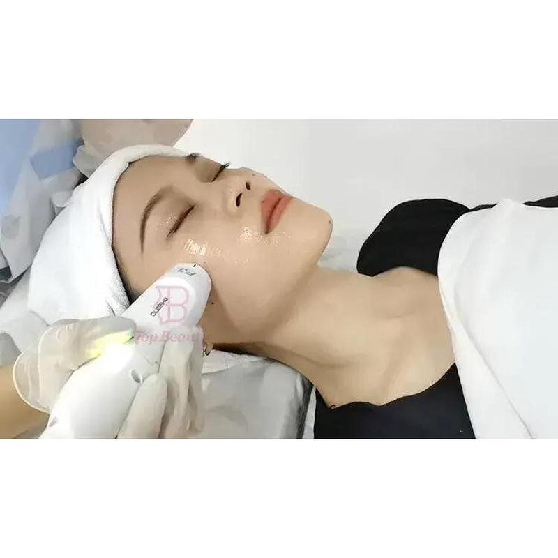 ラジオ周波数マシン Mmfu サイクロン Rf 痛みのない顔のリフト Rf マシン 美肌引き締め しわ取り