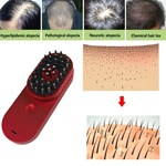 ポータブルミニ電気イオン性ヘアブラシ静電気防止頭皮ヘッドマッサージコーム脱毛機械治療ケア