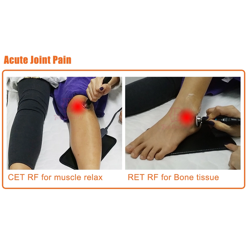 Tecar Therapy Physio 单极射频电阻和电容机 Tecarterapia 专业版