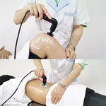 IndibaジアテルミーTecarterapiaスマートマシンRfディープファットバーニングTecar理学療法